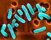 Ecoli [ 14.84 Kb ]